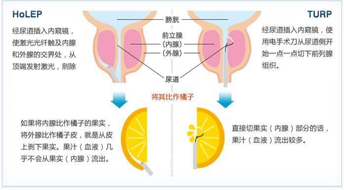 湖南最新疾病概述及其社会影响概览